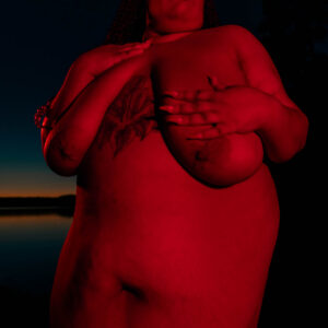 erythema
